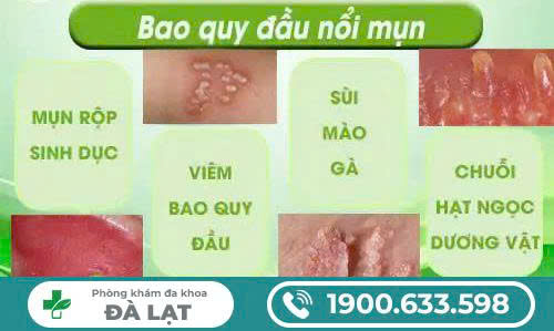 Hình ảnh minh họa